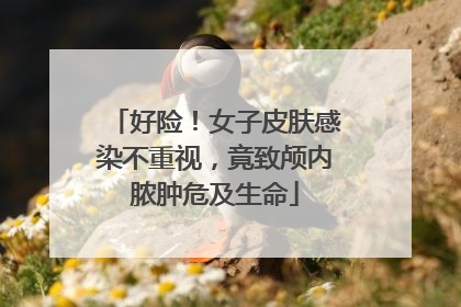 好险！女子皮肤感染不重视，竟致颅内脓肿危及生命